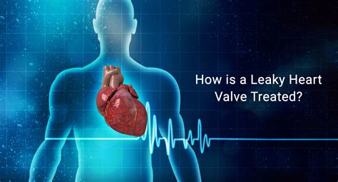 Leaking Heart Valve: Causes and Treatments